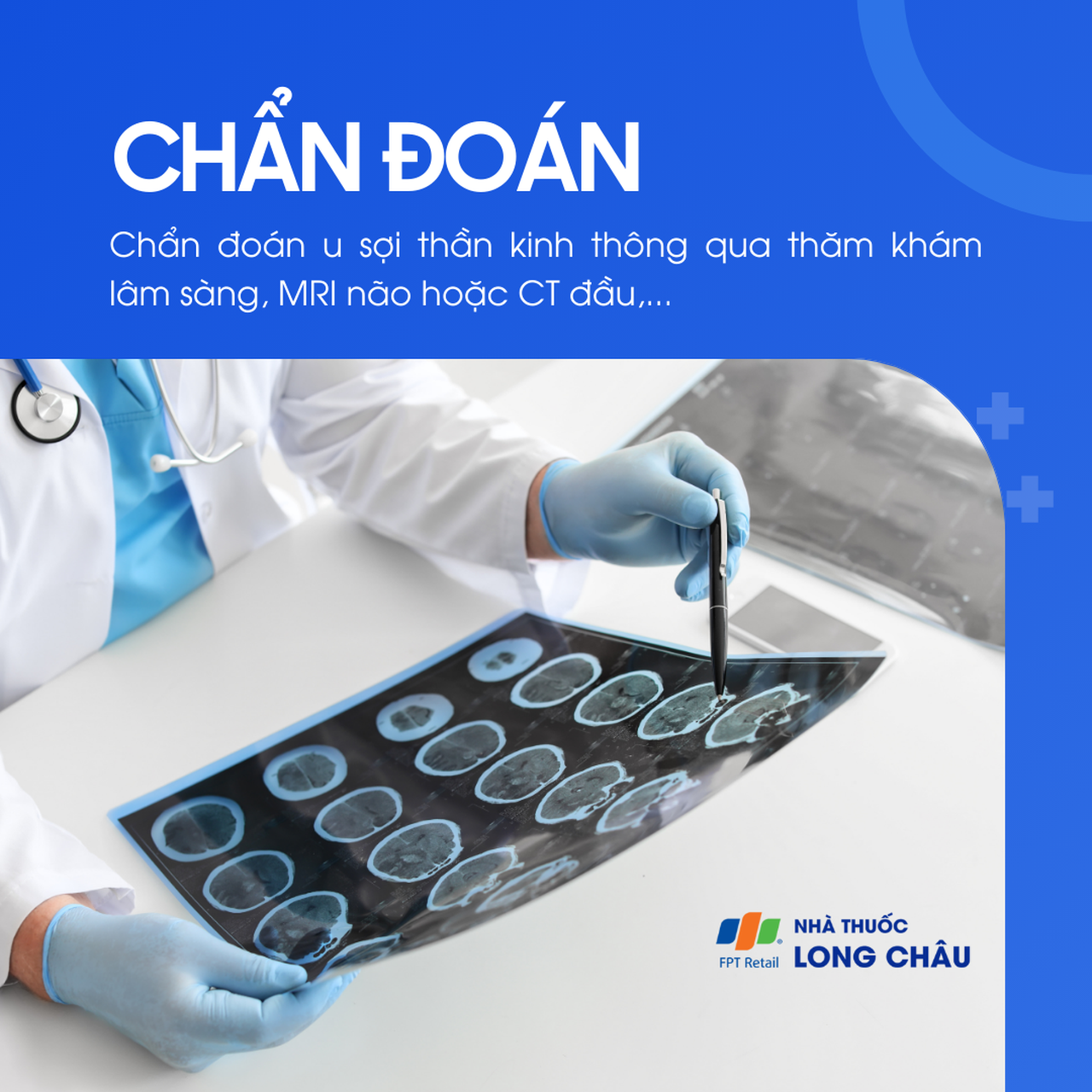 U sợi thần kinh 5