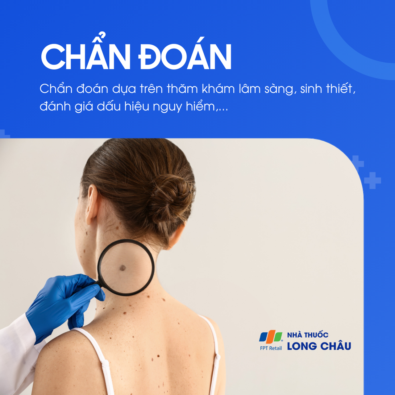 U tế bào hắc tố 5