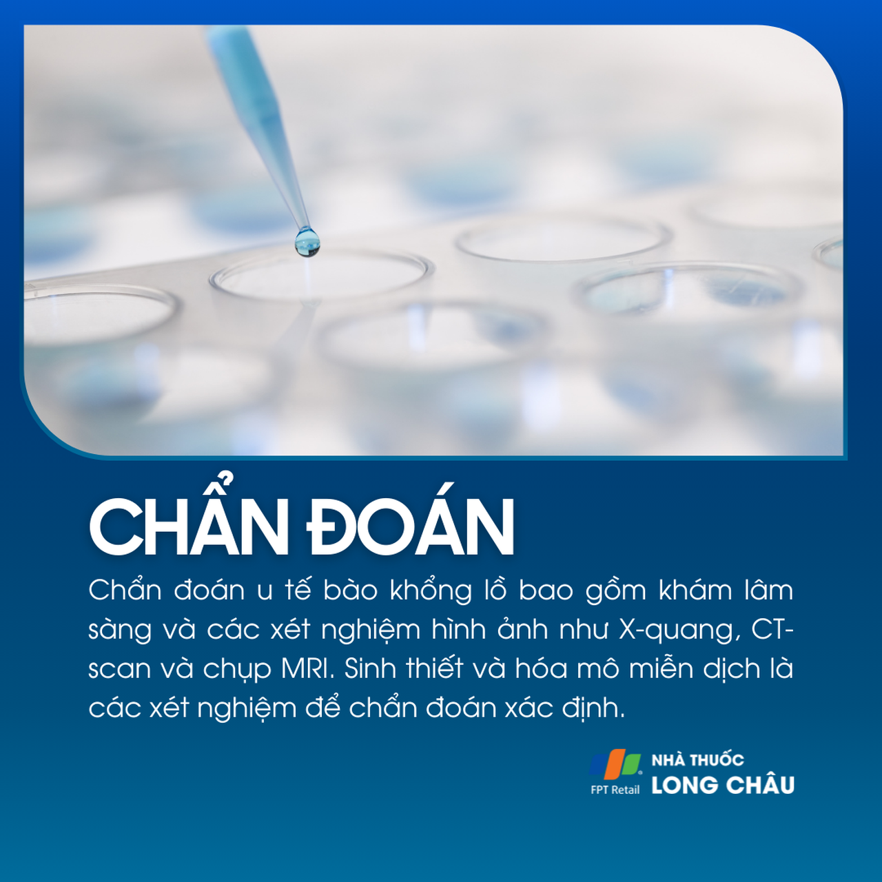 U tế bào khổng lồ 5