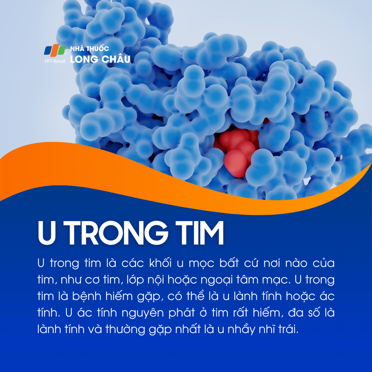 U trong tim 1