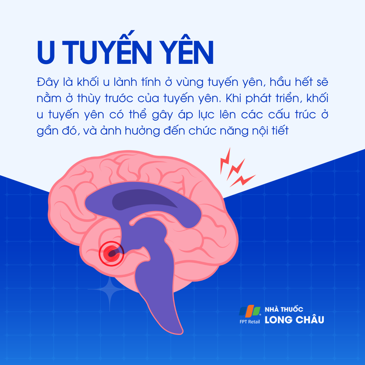 U tuyến yên 1