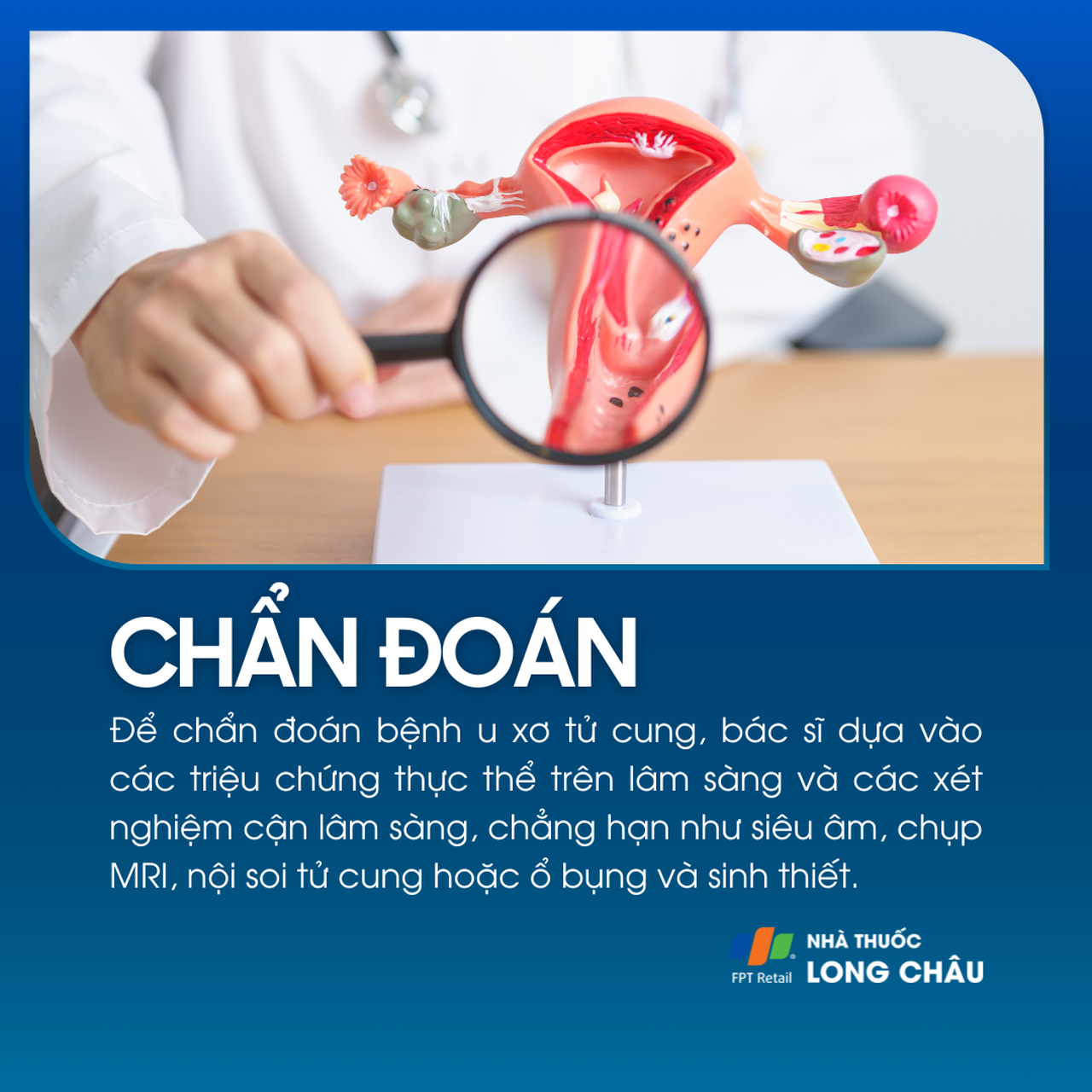 U xơ tử cung 5