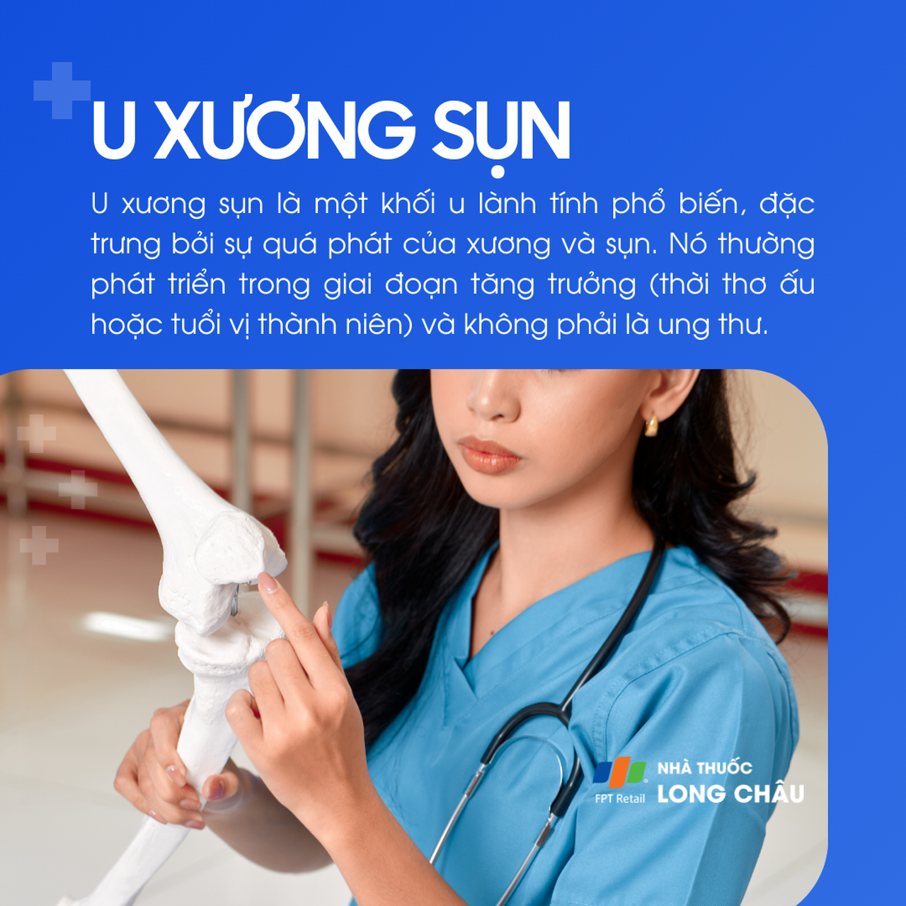 U xương sụn 1