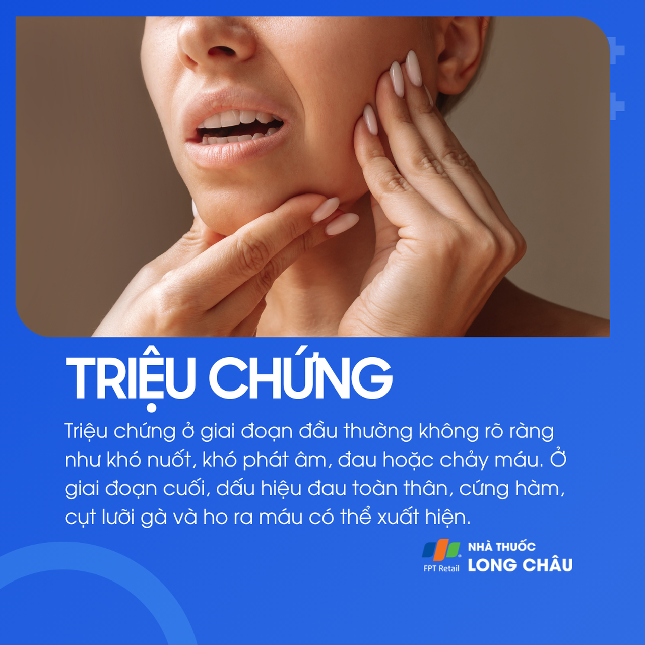 Ung thư amidan khẩu cái 2