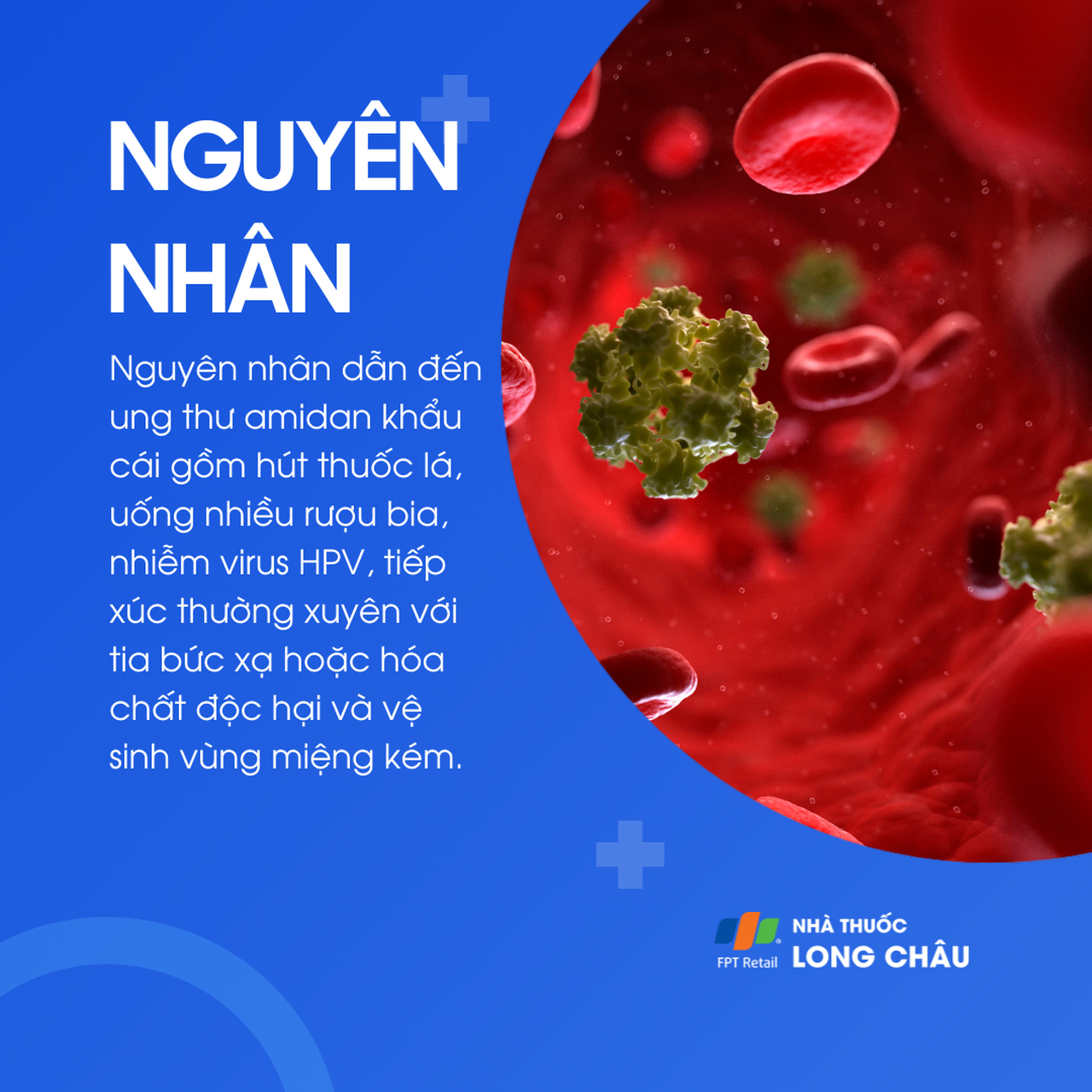 Ung thư amidan khẩu cái 3