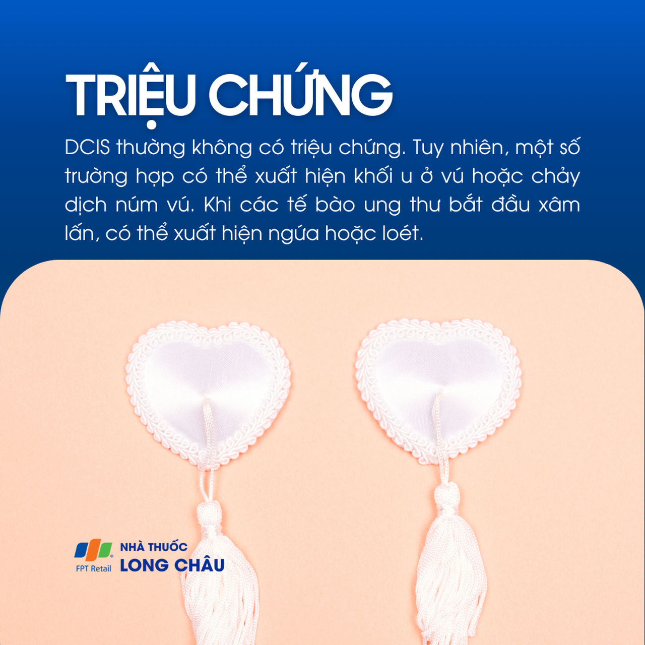 Ung thư biểu mô ống dẫn sữa tại chỗ 2