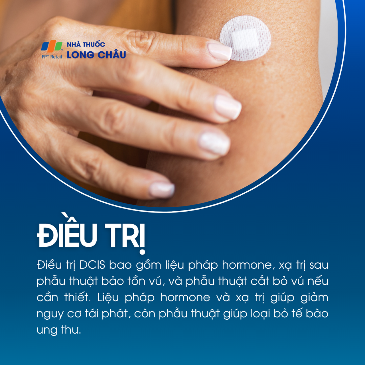 Ung thư biểu mô ống dẫn sữa tại chỗ 6