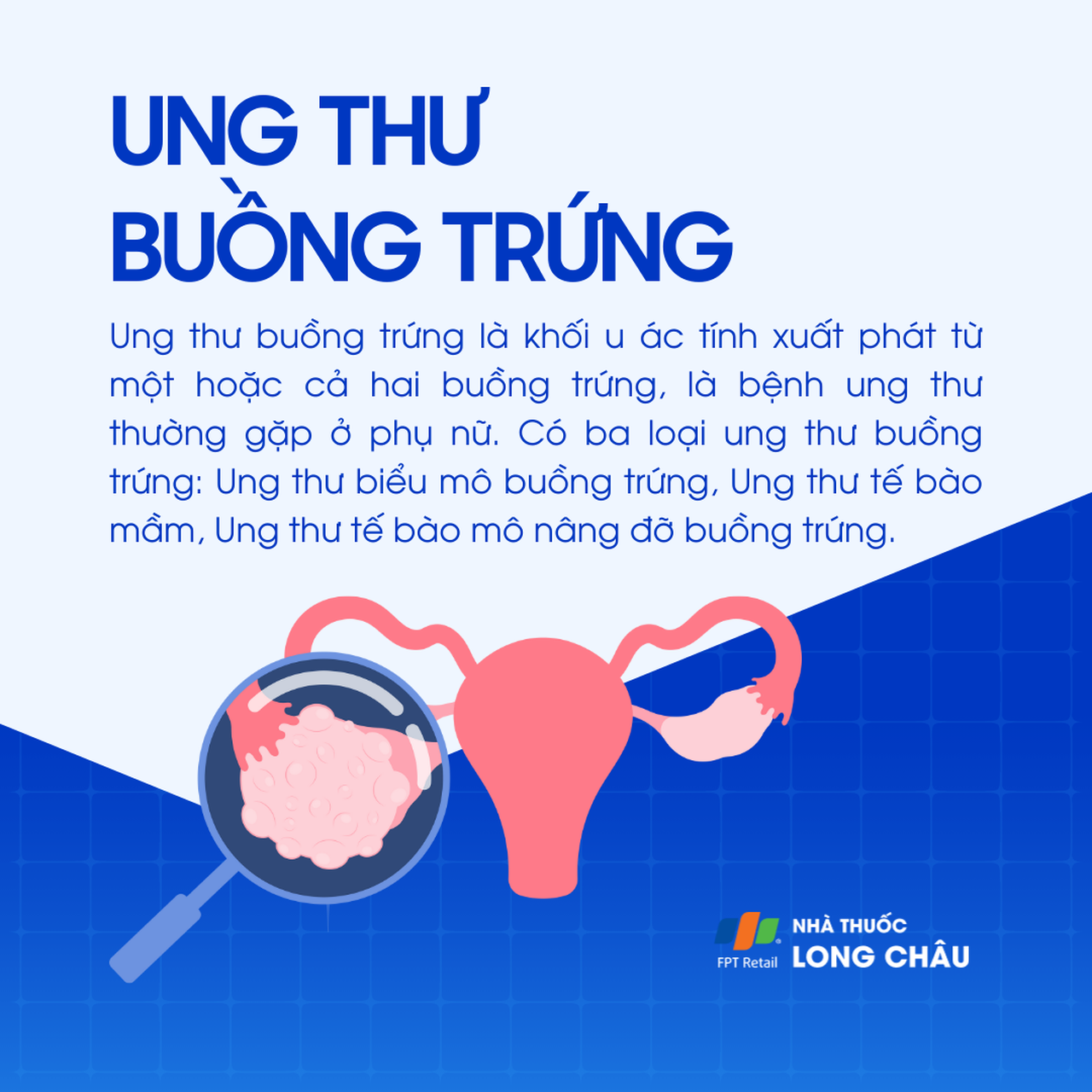 Ung thư buồng trứng 1