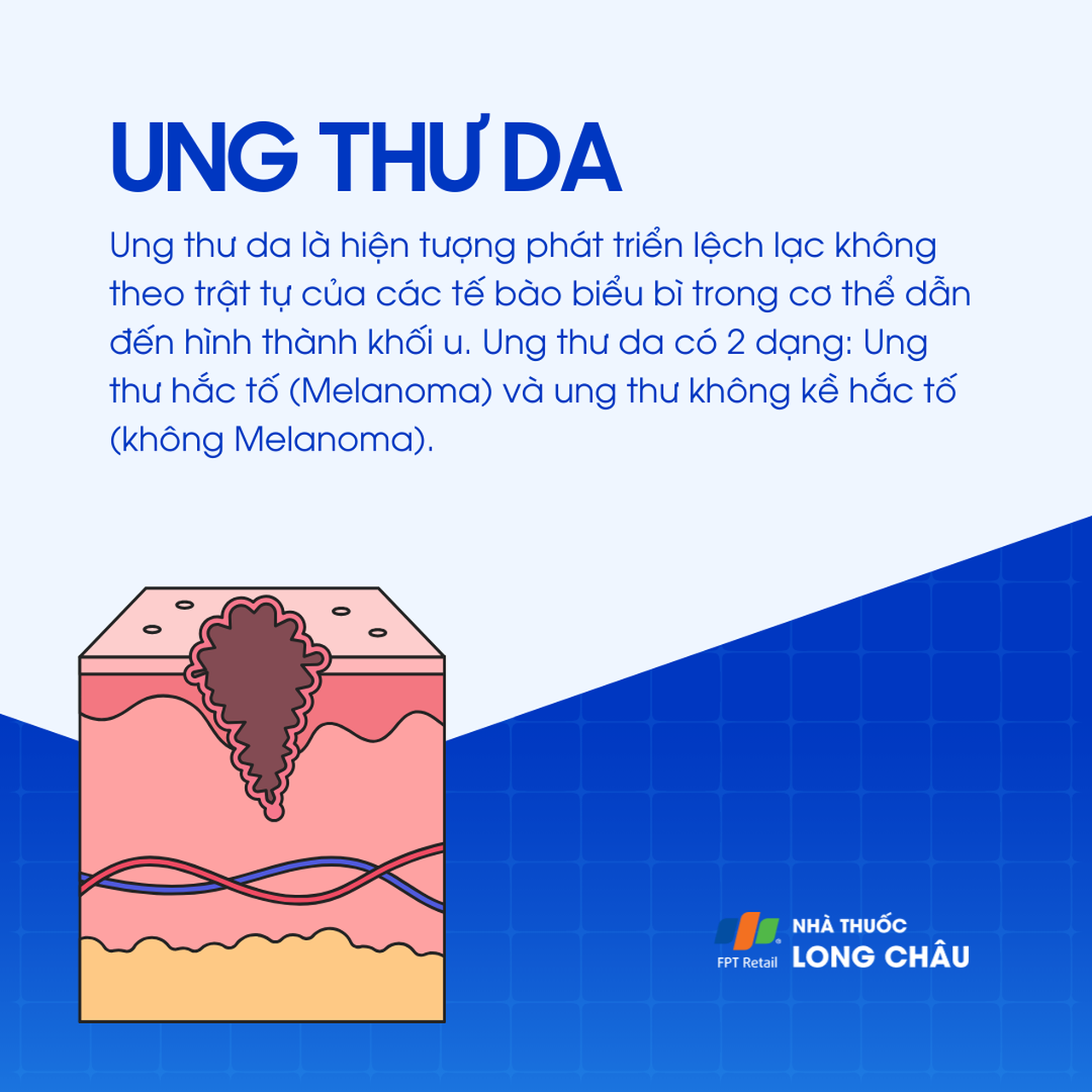 Ung thư da 1