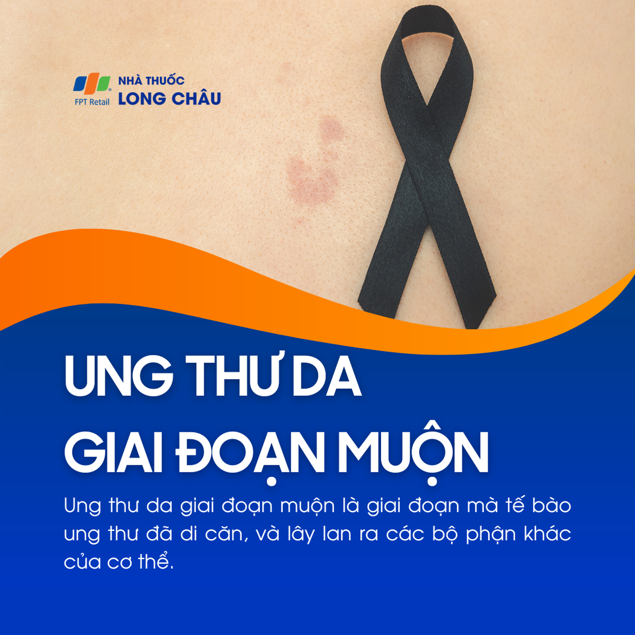 Ung thư da giai đoạn muộn 1