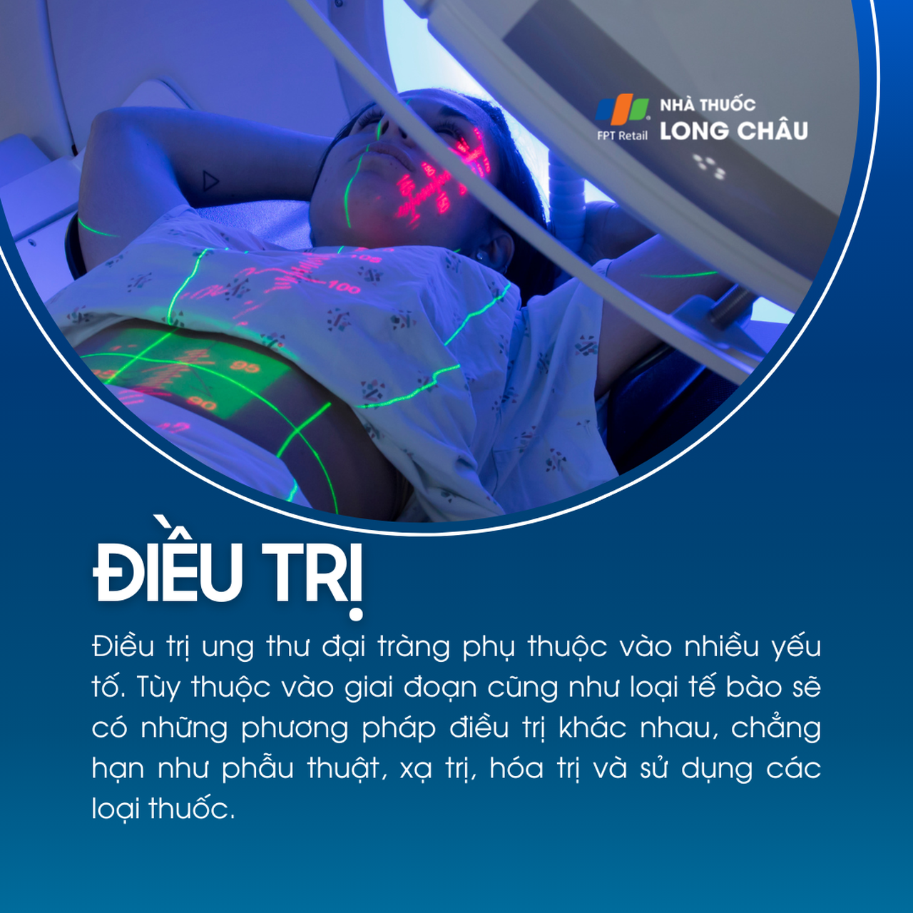 Ung thư đại tràng 6