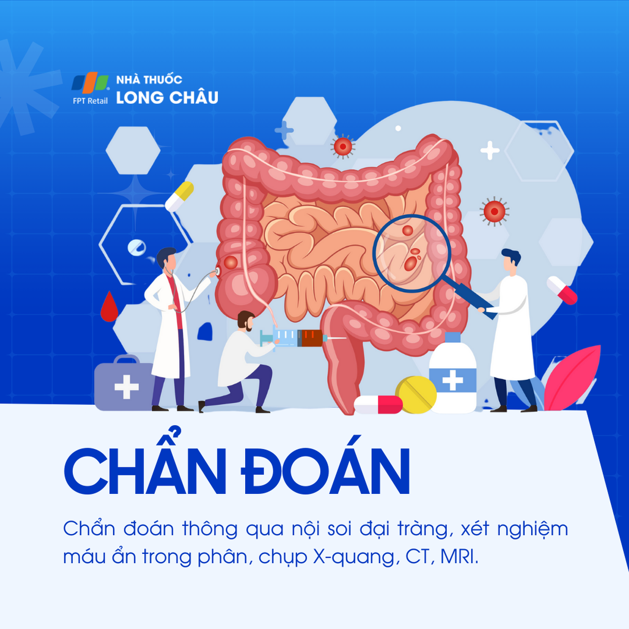 Ung thư đại tràng giai đoạn 2 5