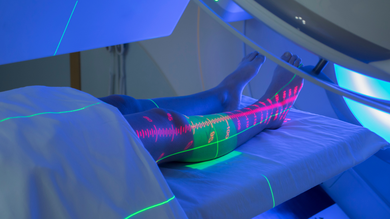 Ung thư mô liên kết 3