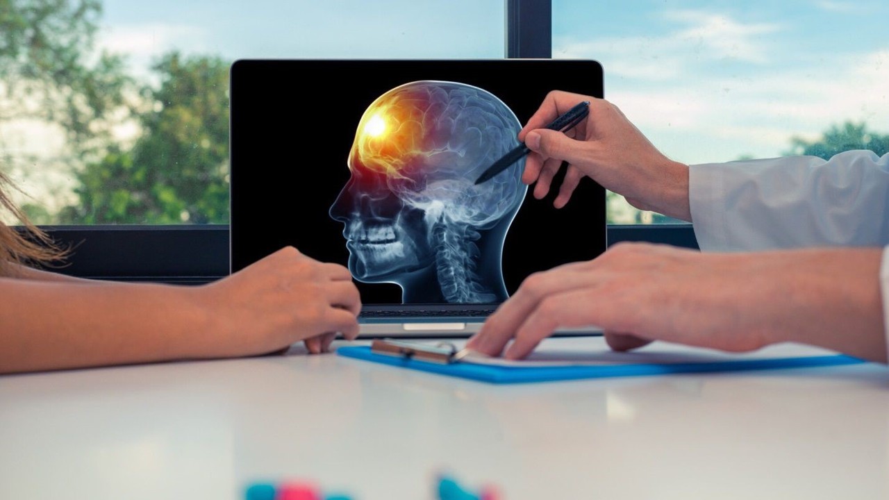 Ung thư não: Triệu chứng, nguyên nhân và cách điều trị 2