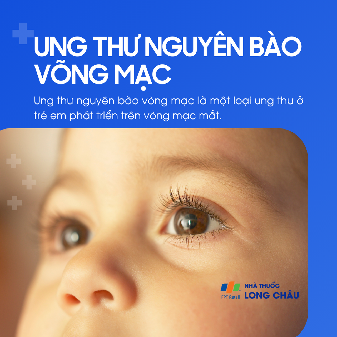 Ung thư nguyên bào võng mạc 1