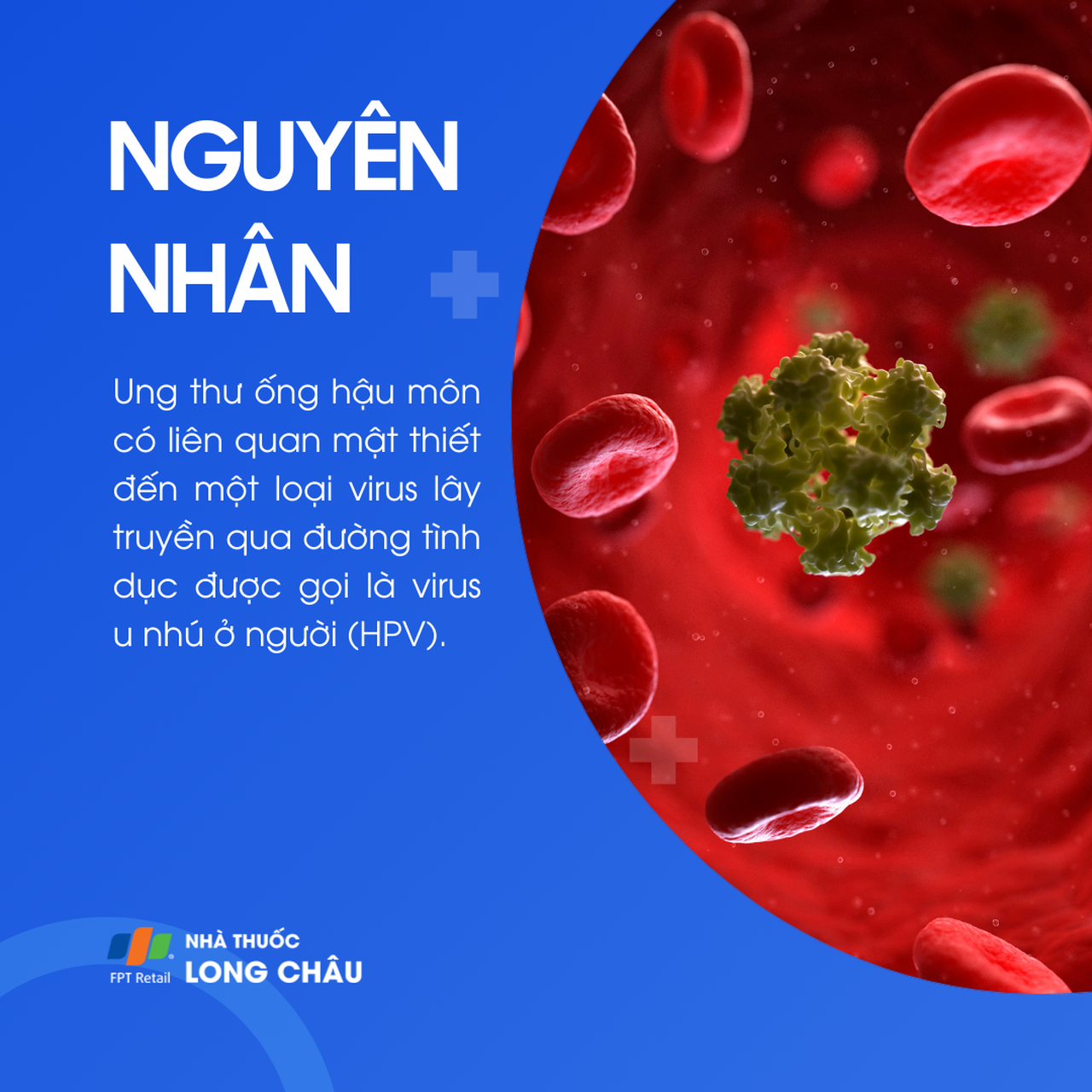 Ung thư ống hậu môn 3