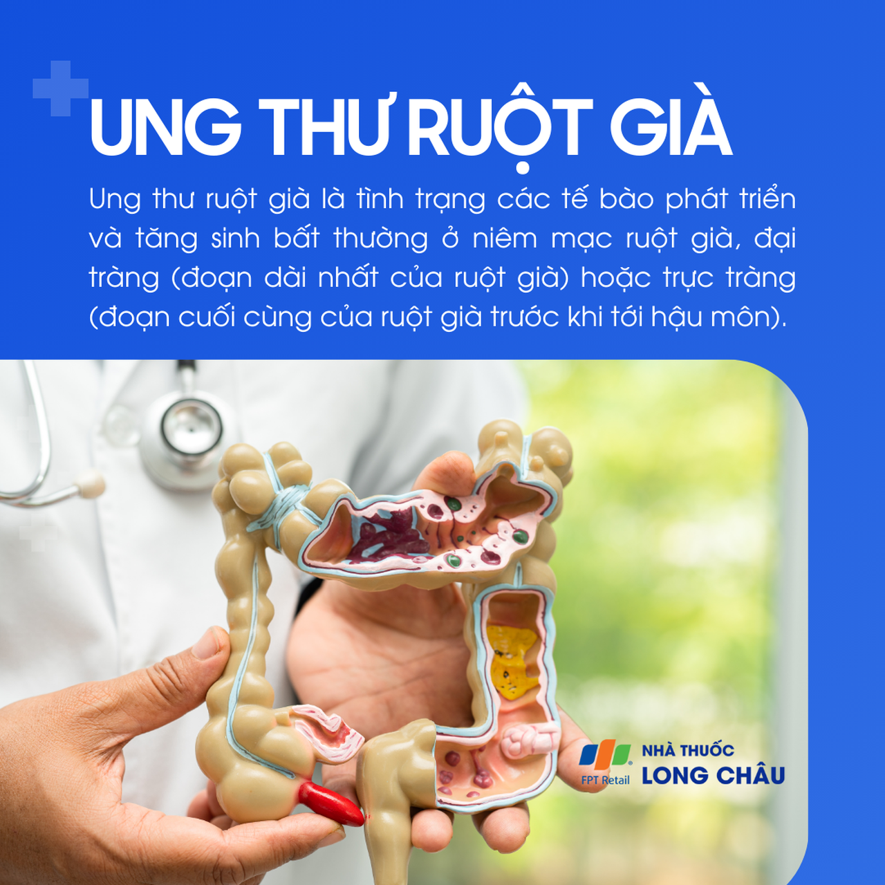Ung thư ruột già 1