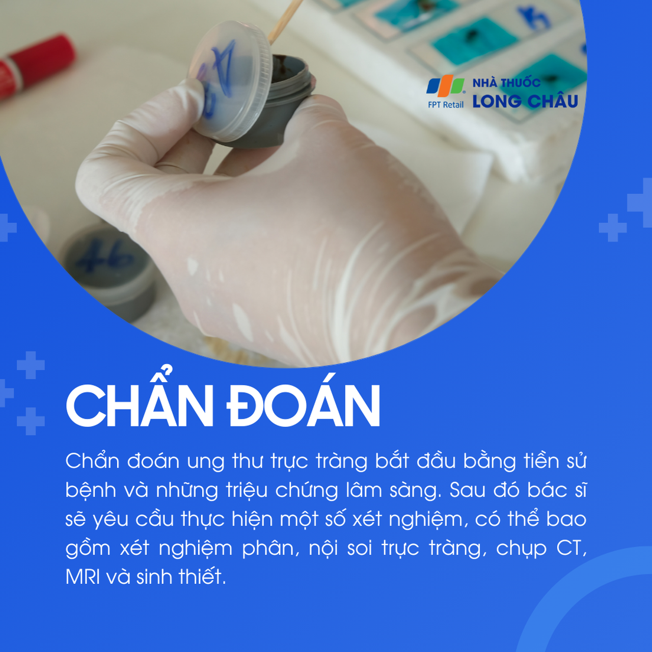 Ung thư trực tràng 5