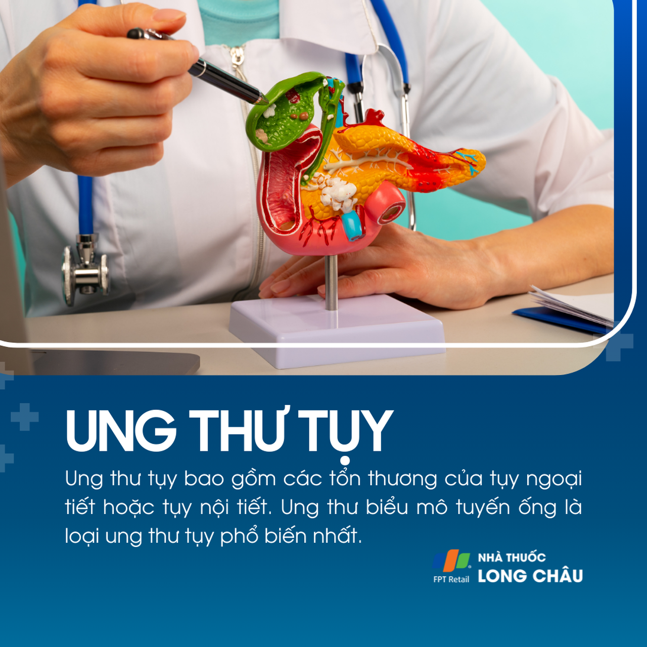 Ung thư tụy 1