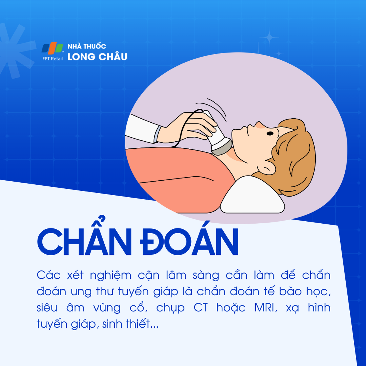 Ung thư tuyến giáp 5