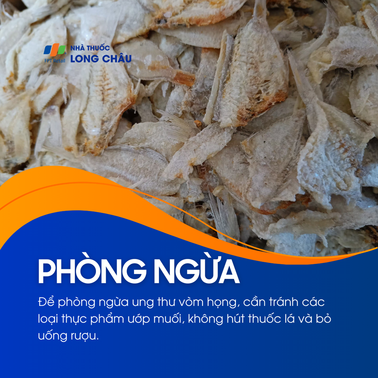 Ung thư vòm họng 7