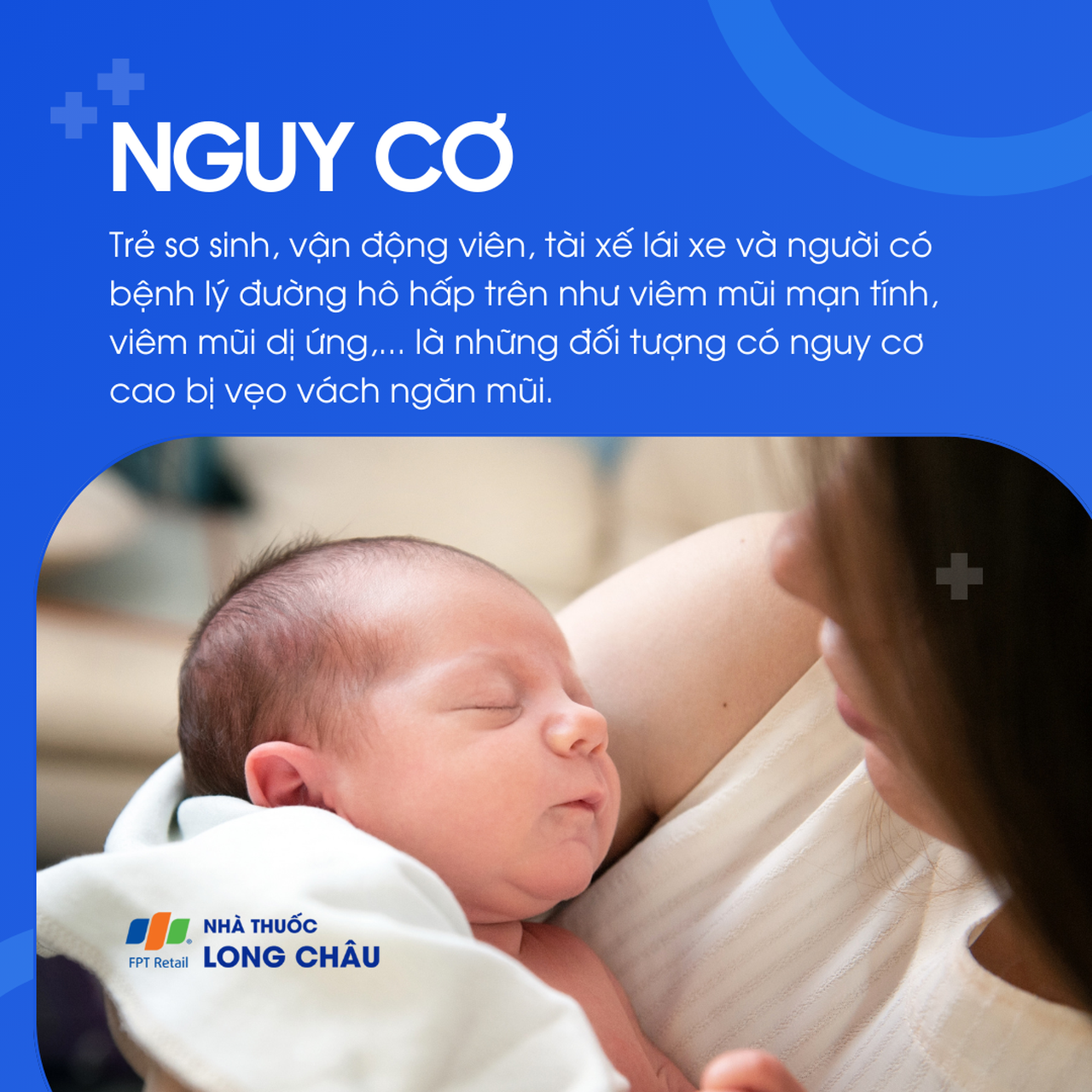 Vẹo vách ngăn mũi 4
