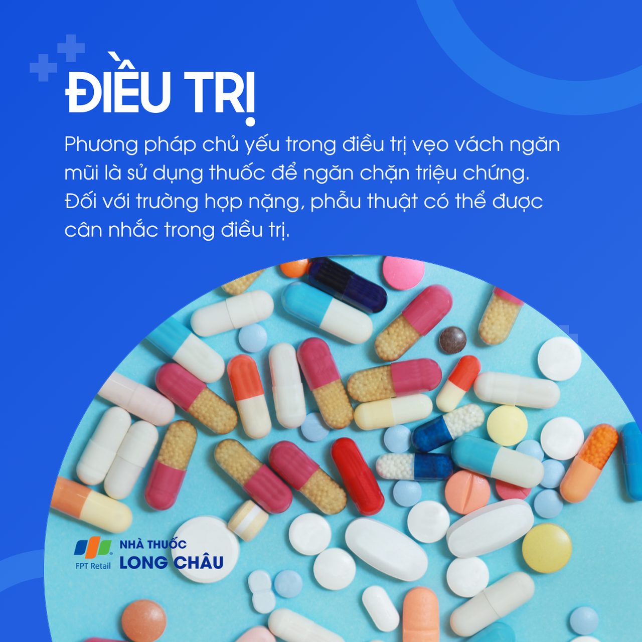 Vẹo vách ngăn mũi 6