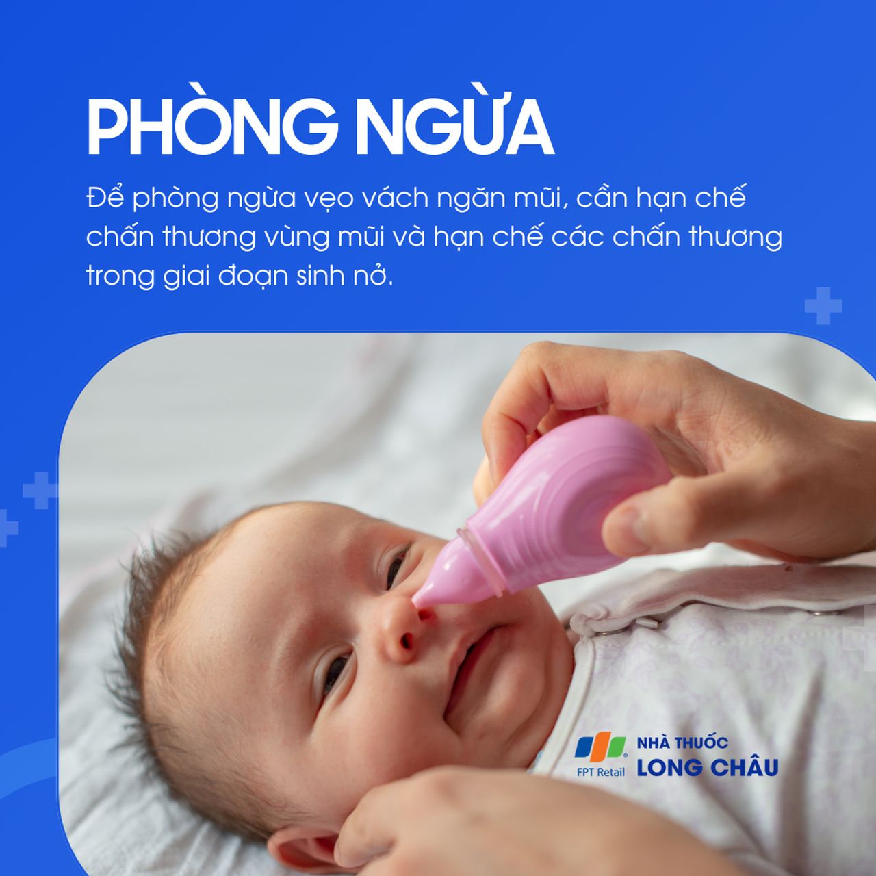 Vẹo vách ngăn mũi 7