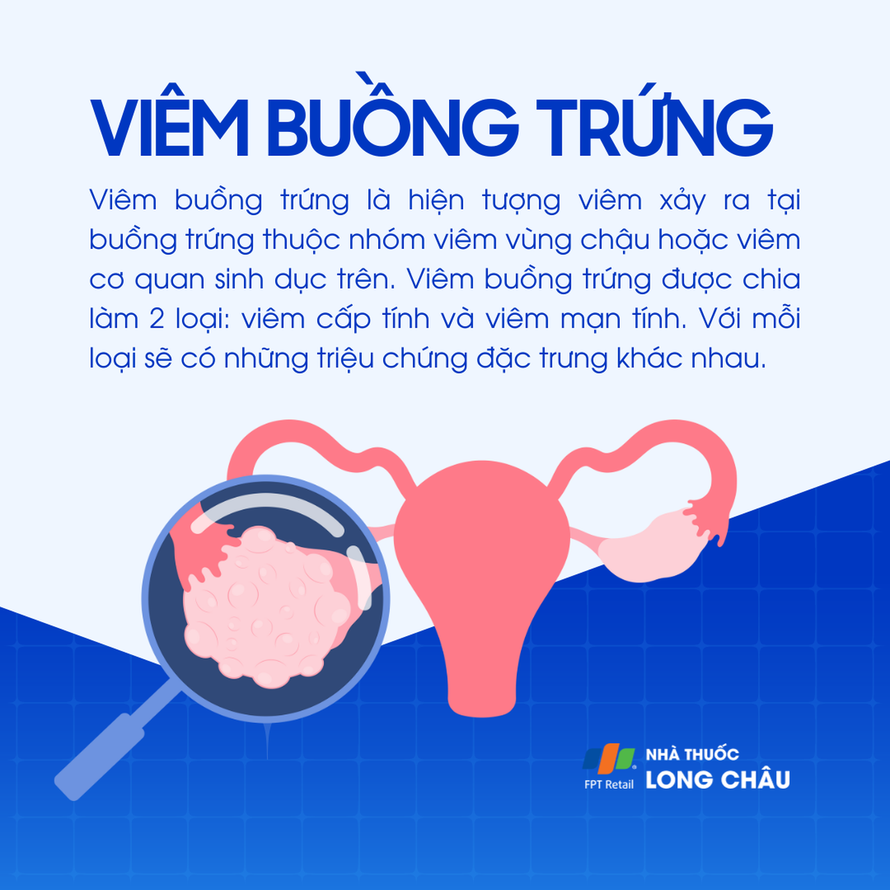 Viêm buồng trứng 1