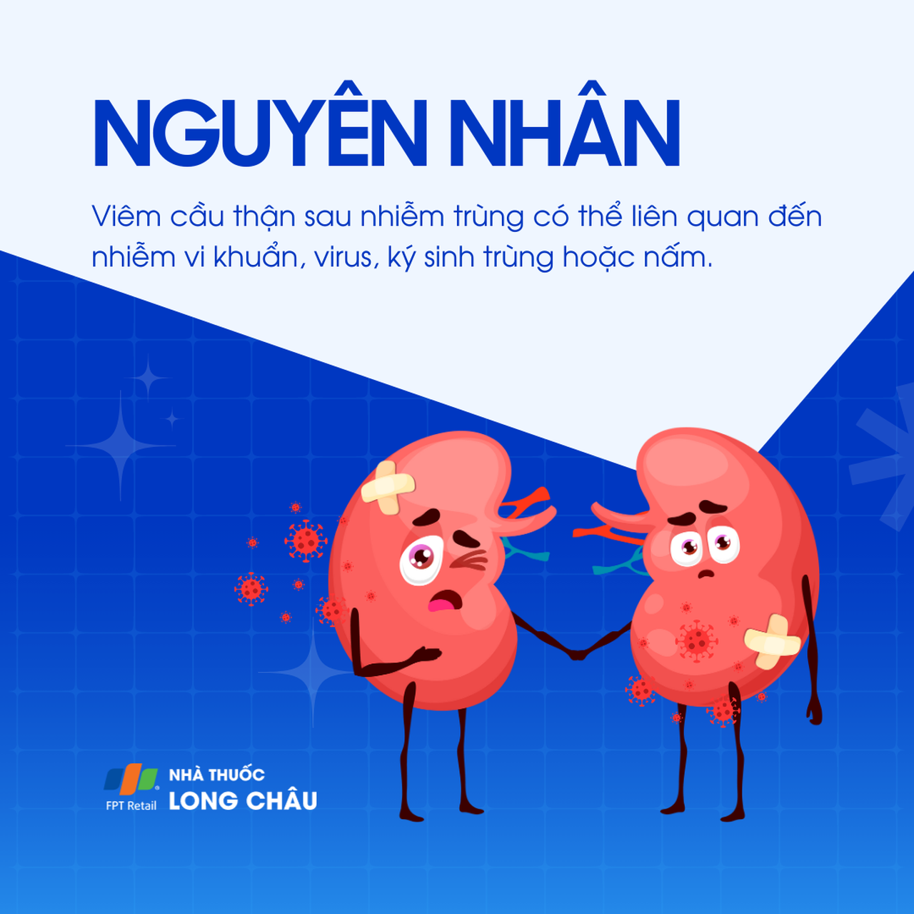 Viêm cầu thận sau nhiễm trùng 3