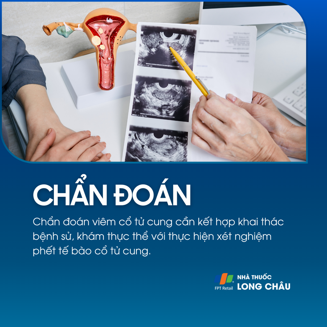 Viêm cơ tử cung 5