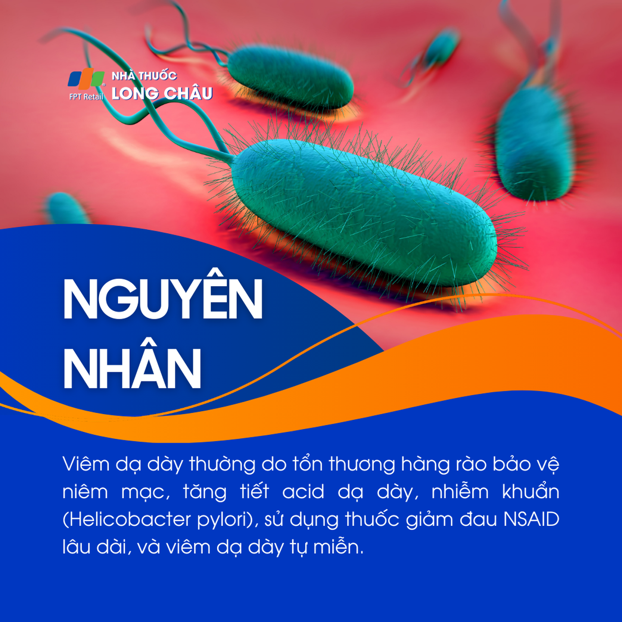 Viêm dạ dày 3