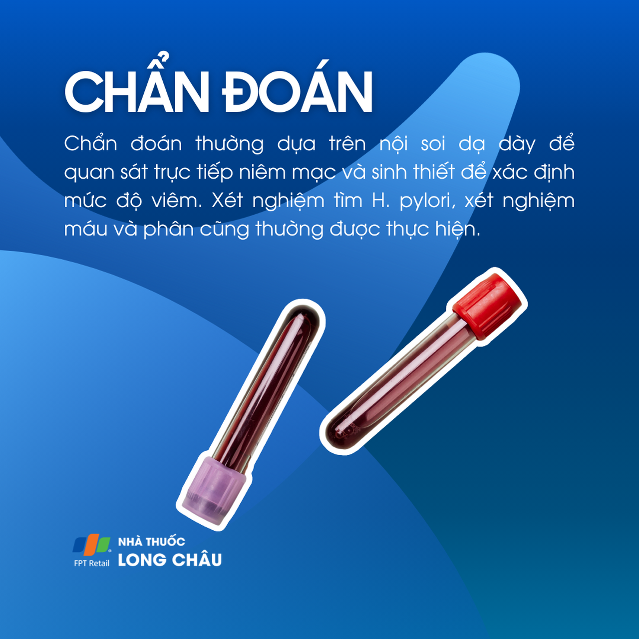Viêm dạ dày mạn tính 5