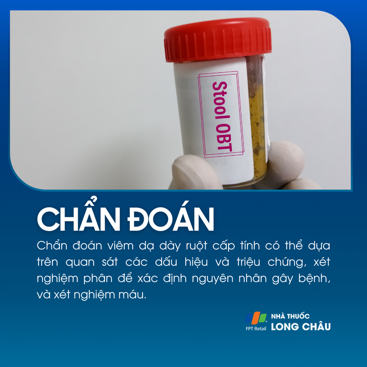 Viêm dạ dày ruột cấp tính 5