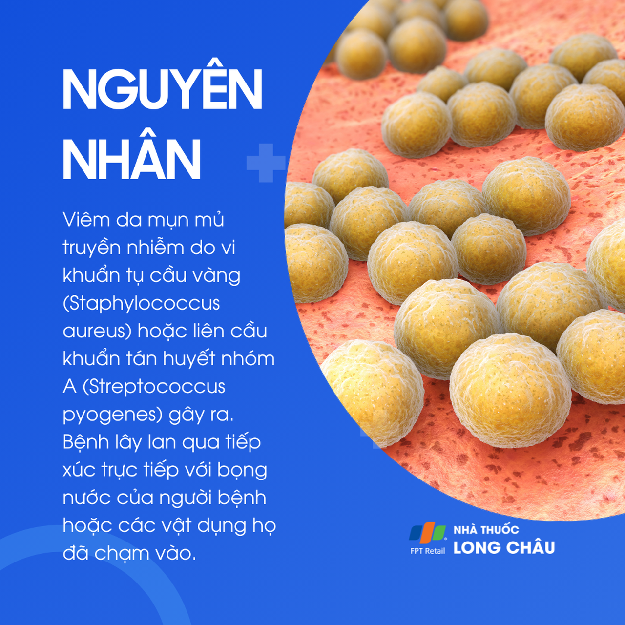 Viêm da mụn mủ truyền nhiễm 3