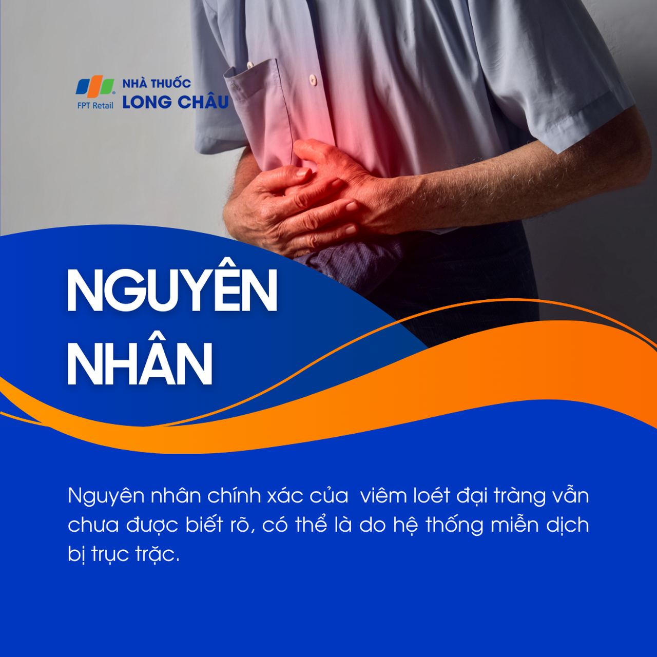 Viêm đại tràng 3