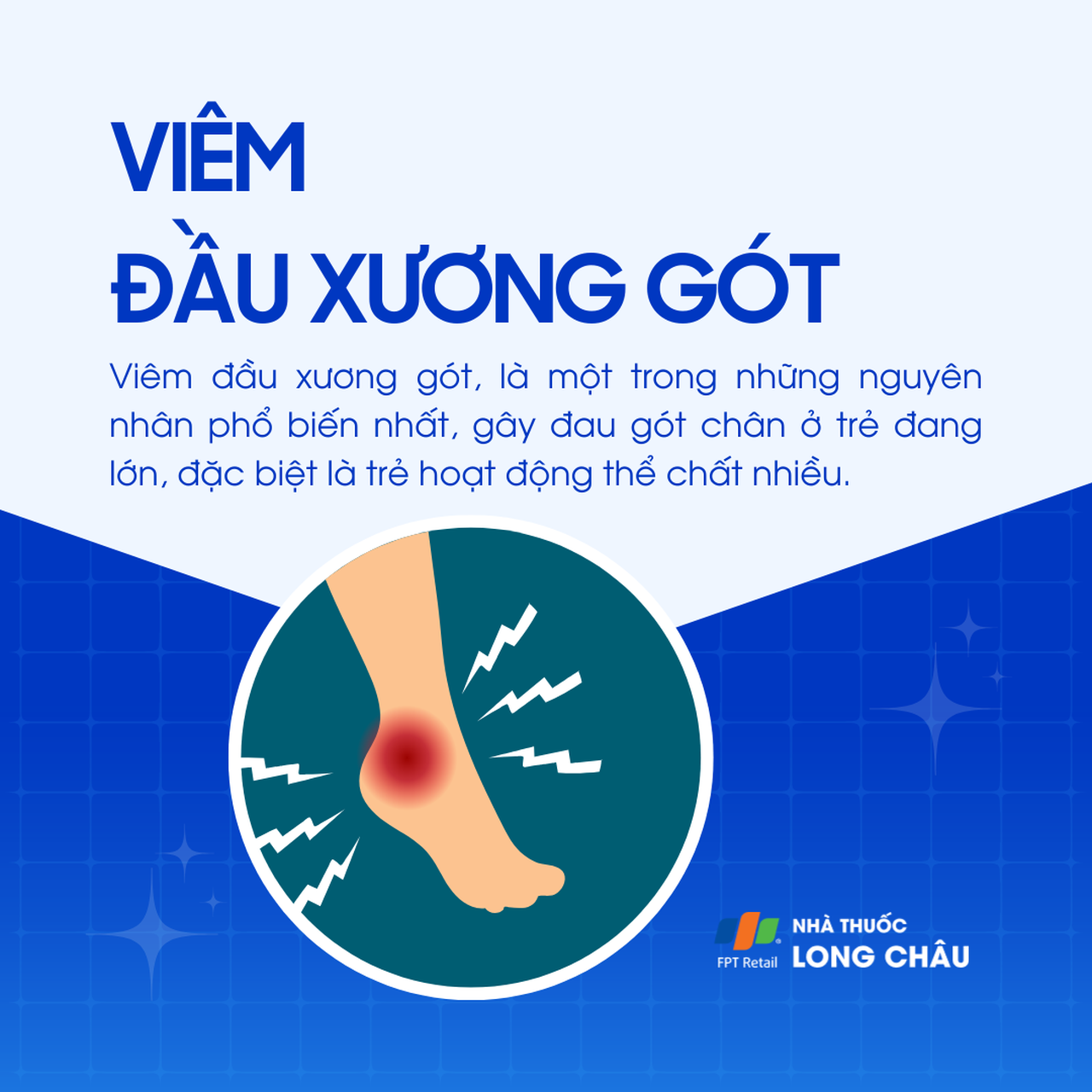 Viêm đầu xương gót 1