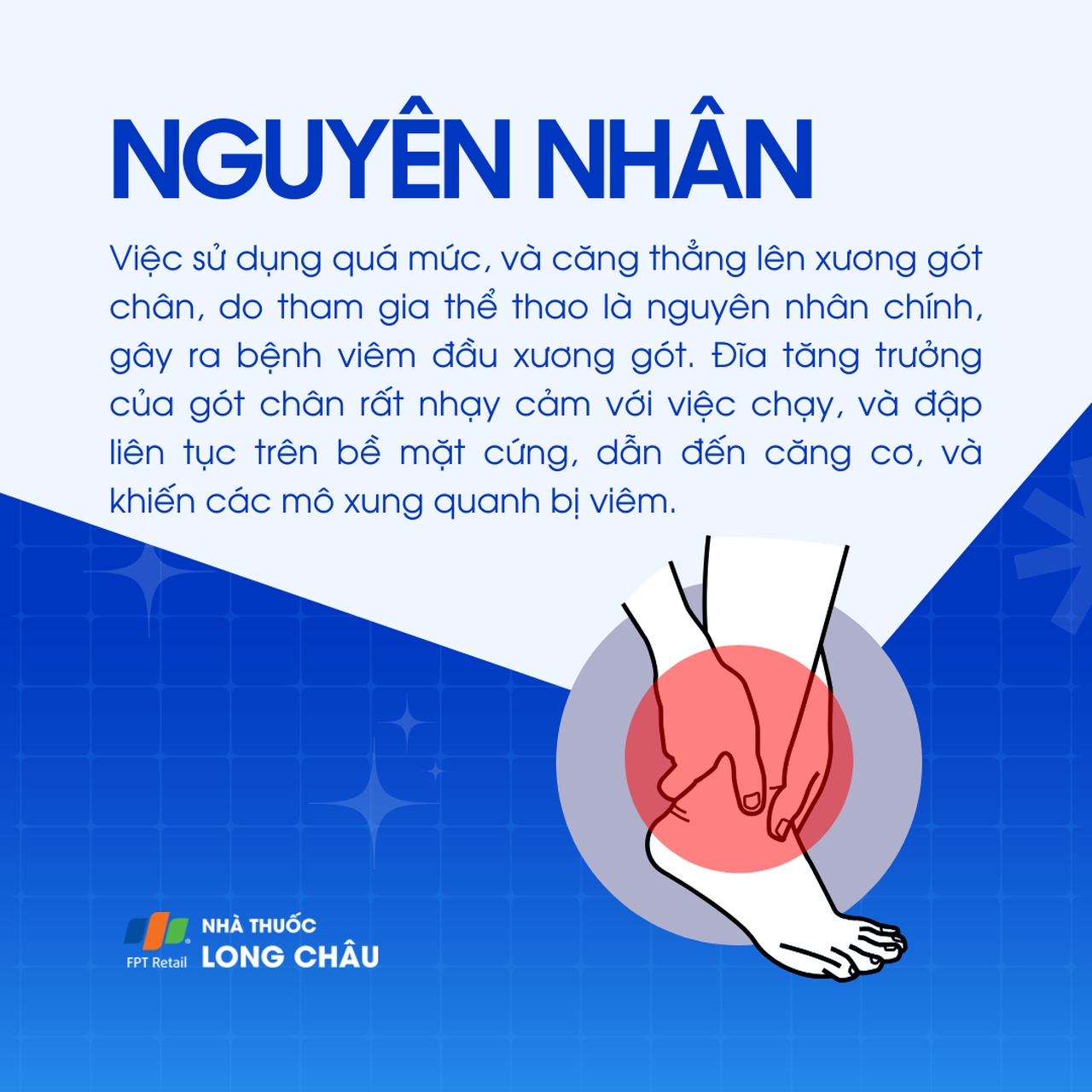 Viêm đầu xương gót 3