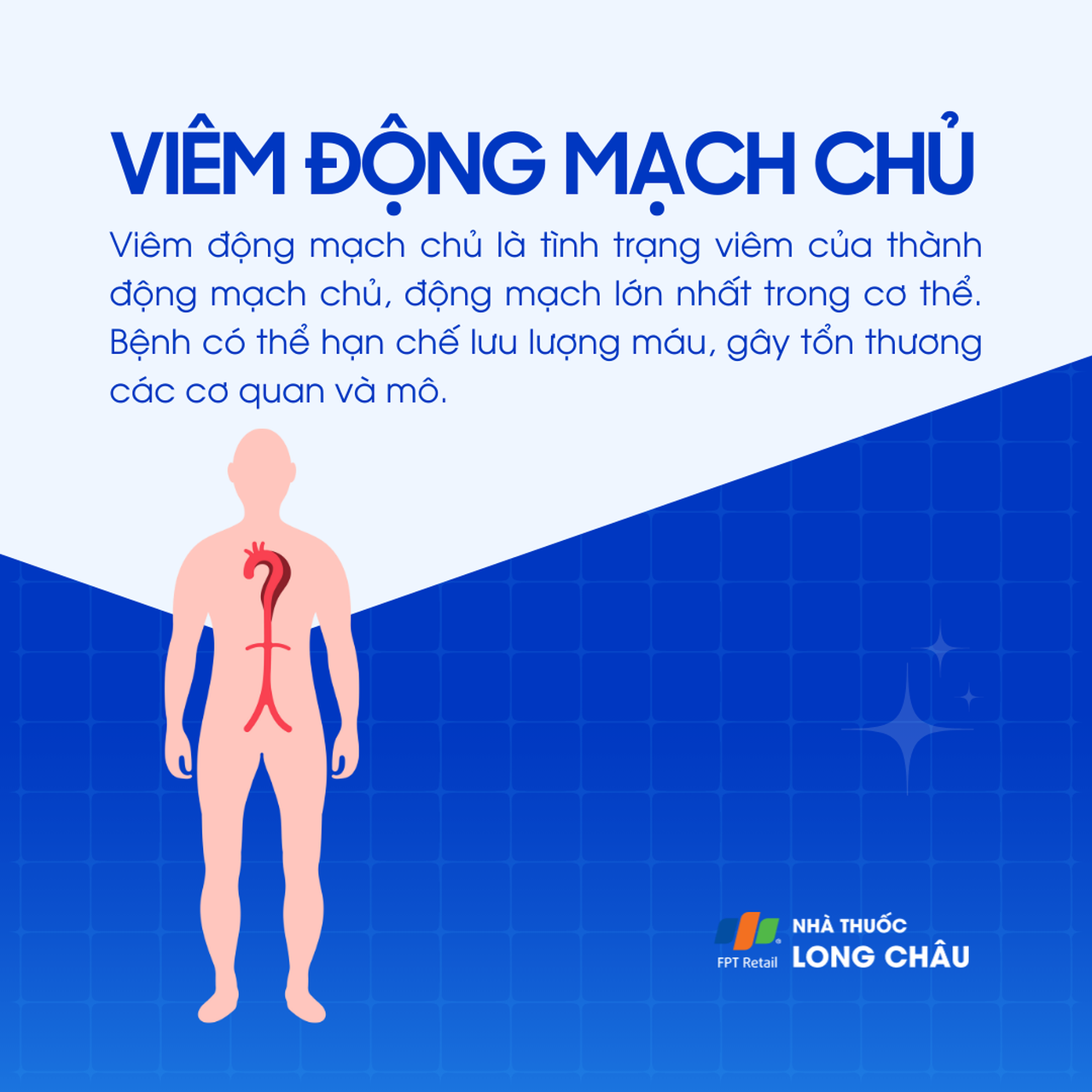 Viêm động mạch chủ 1