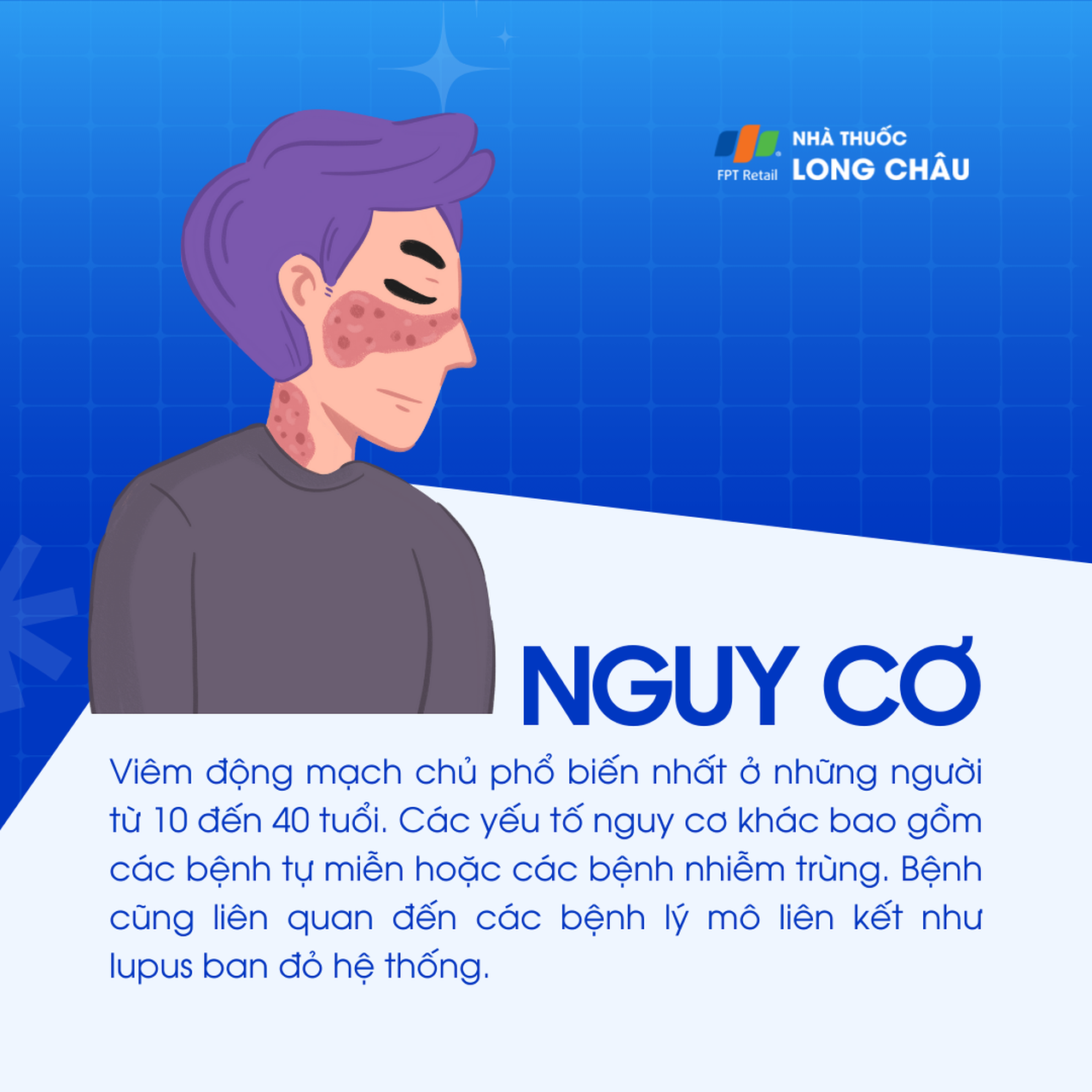 Viêm động mạch chủ 4