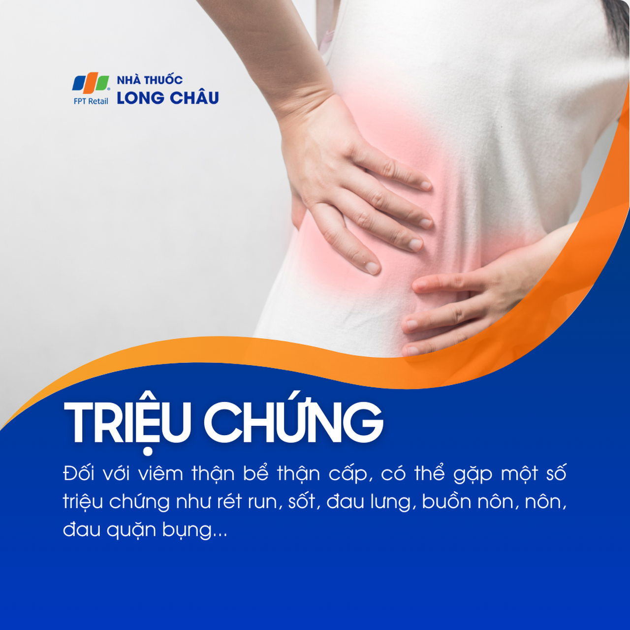 Viêm thận bể thận cấp có thể gây rét run, sốt, đau lưng, buồn nôn, nôn và đau quặn bụng