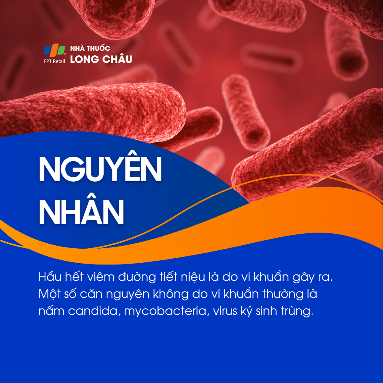 Nguyên nhân chủ yếu do vi khuẩn, một số do nấm Candida, mycobacteria hoặc virus ký sinh trùng