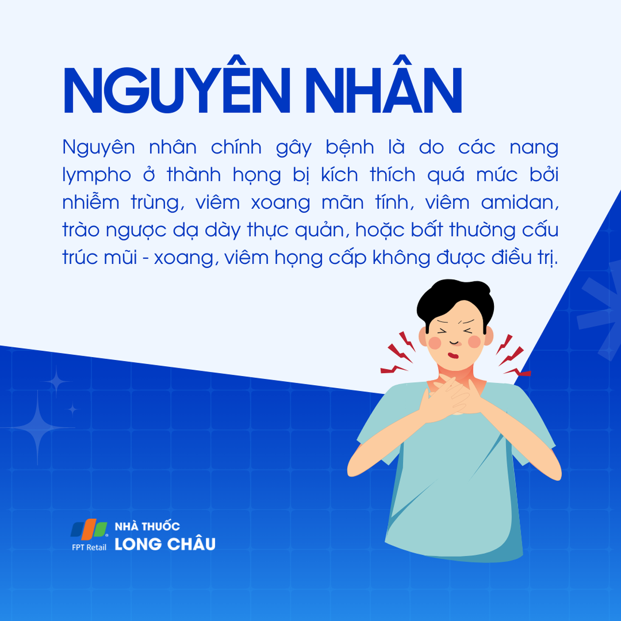 Viêm họng hạt mạn tính 3