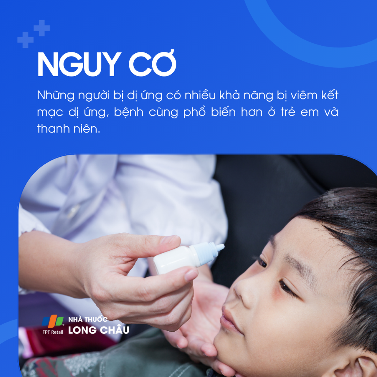 Viêm kết mạc dị ứng 4