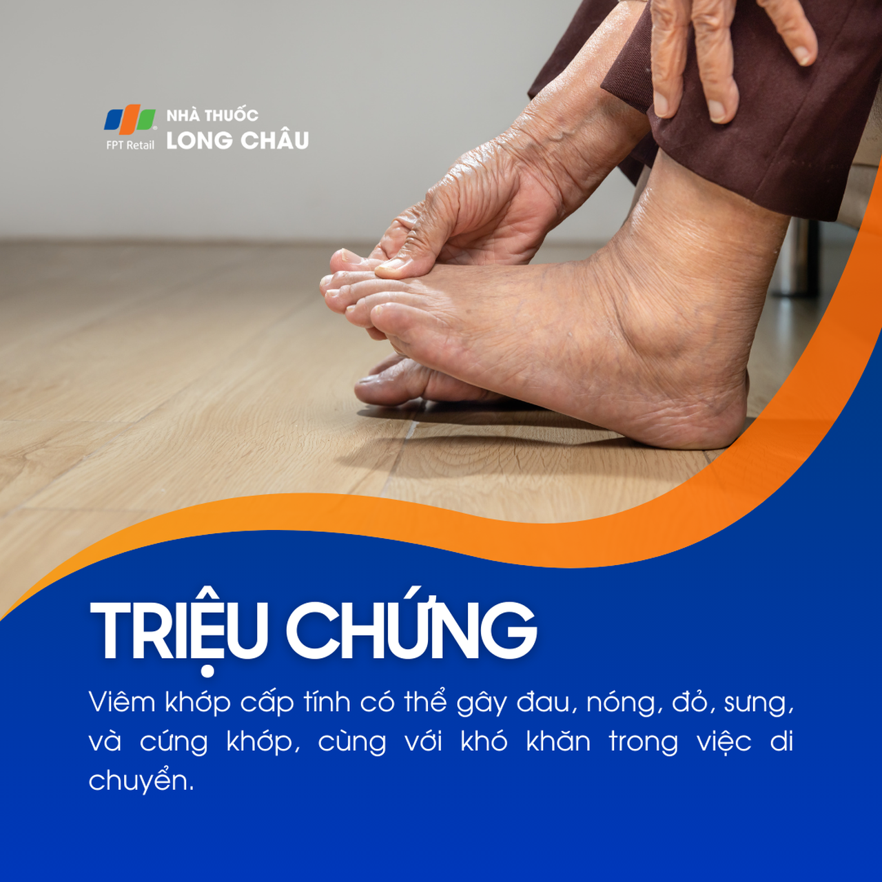 Viêm khớp cấp 2