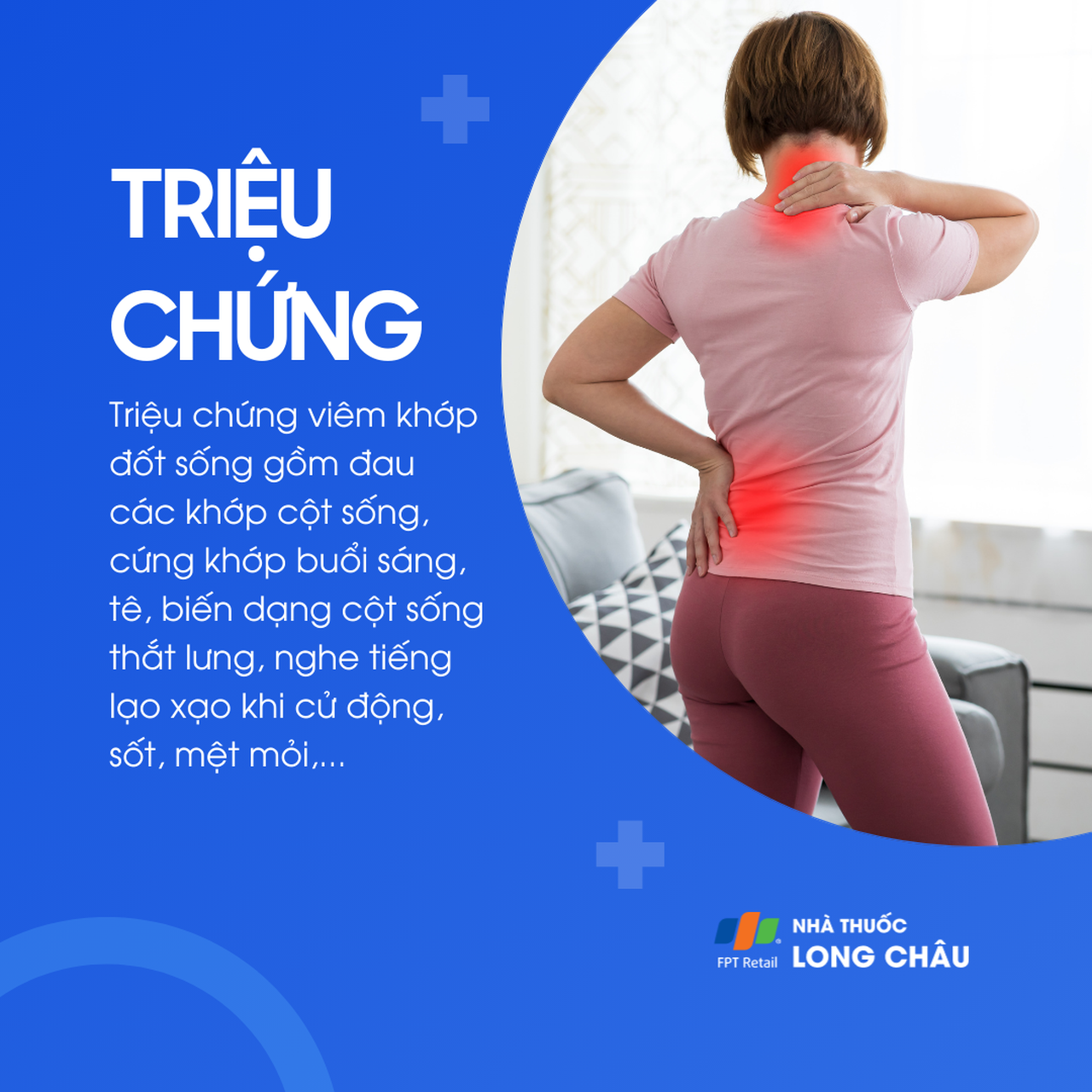 Viêm khớp đốt sống 2