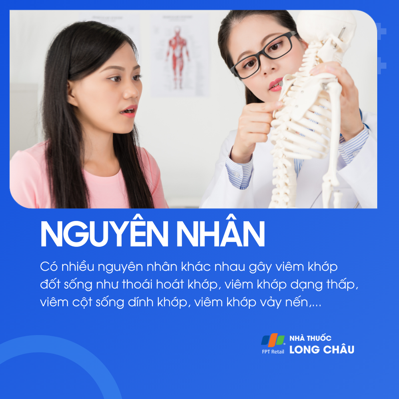 Viêm khớp đốt sống 3