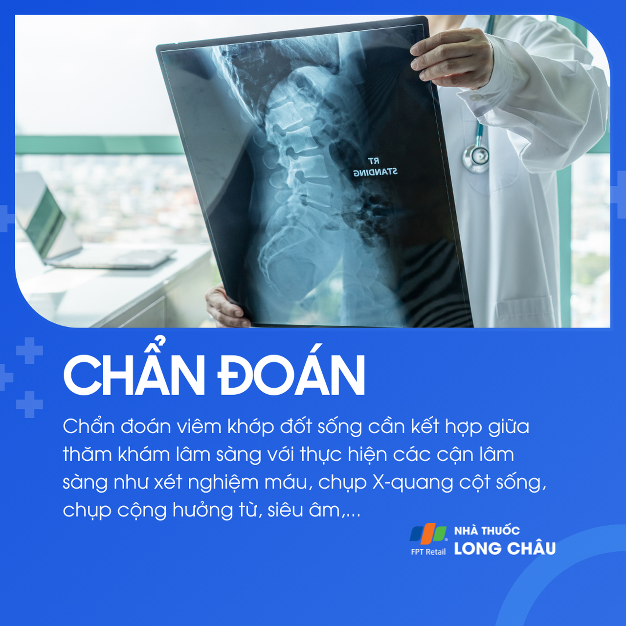 Viêm khớp đốt sống 5