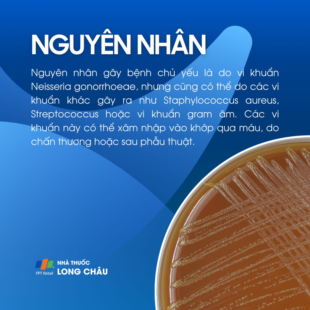 Viêm khớp nhiễm khuẩn sinh mủ 3