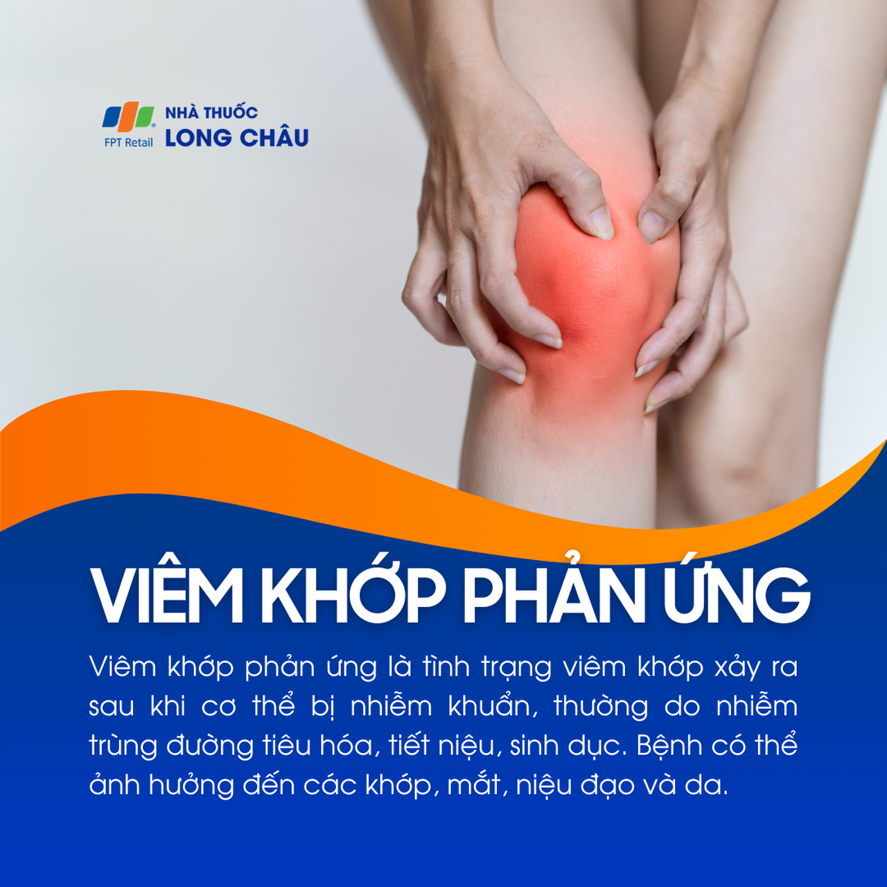 Viêm khớp phản ứng 1